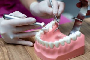 Trexler Family Dental Group Dental Implant